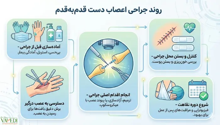 روند جراحی اعصاب دست چگونه است؟ (قدمبهقدم)