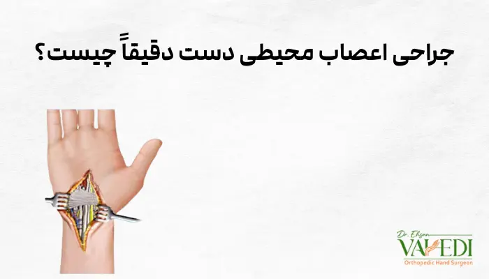 جراحی اعصاب محیطی دست دقیقاً چیست؟