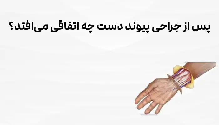 پس از جراحی پیوند دست چه اتفاقی میافتد؟